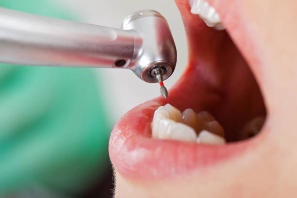 Best Emergency Treatment for Toothache in Denver, IA